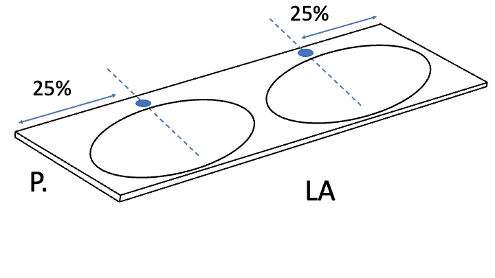 Plan vasque Design, fabrication sur mesure, Largeur 60 à 20 cm x Profondeur 40 à 60 cm, résine minérale ACRYSTONE® SOLID-SURFACE Finition lisse blanc mate, Livraison Offerte et Rapide.